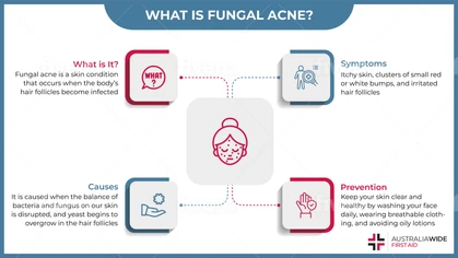 Infographic on Fungal Acne Causes, Symptoms, and Treatment