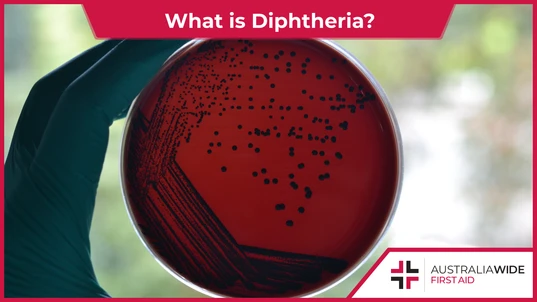 diphtheria-symptoms-and-causes