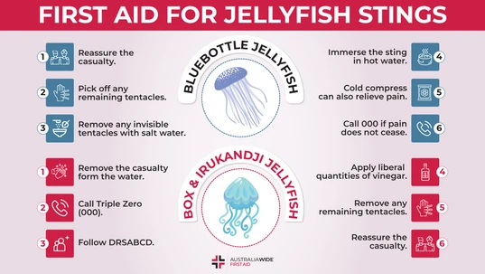 Infographic about First Aid for Jellyfish Stings 