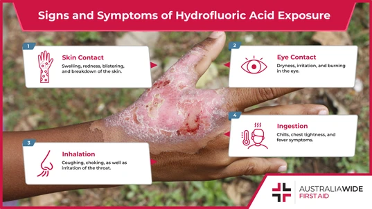 Hydrofluoric Acid Burn 