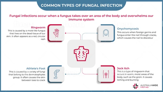 Infographic on Common Types of Fungal Infections 