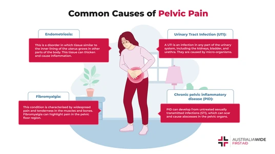 Infographic on What Pelvic Pain Is