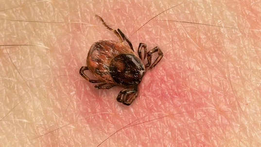 Paralysis Tick bite causing an allergic reaction