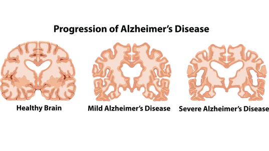 An Anatomy of Human Brain illustration