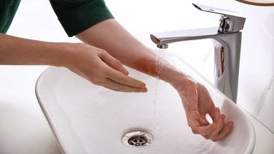 Woman putting burned hand under running cold water indoors, closeup